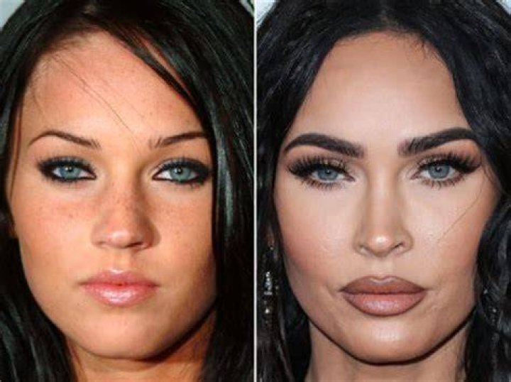 Biagio Lazaric’s Girlfriend Kyla Yesenosky Looks Quite Different Now – Here Are Before And After Pictures