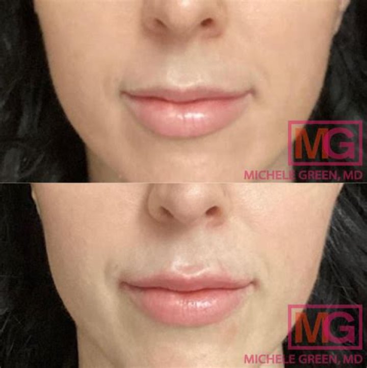 Bianca Kajlich Plastic Surgery Photos, Botox And Lip Fillers, Has She Done Nose Job?