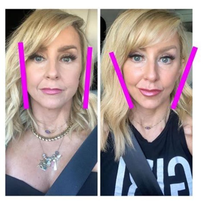 Chalene Johnson Plastic Surgery Photos – Before and After, How Does She Look Now?