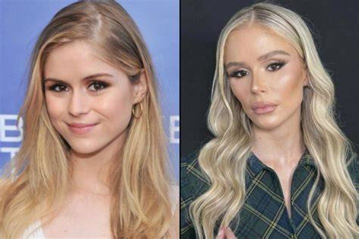 Erin Brodie: Dr Will Wikipedia, Biography, Big Brother Wife, Net Worth and Plastic Surgery