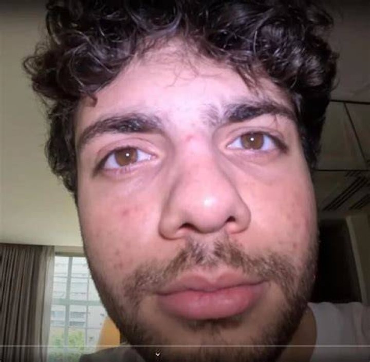Who Is Musical Artist Spoonkid & Has He Revealed His Face?